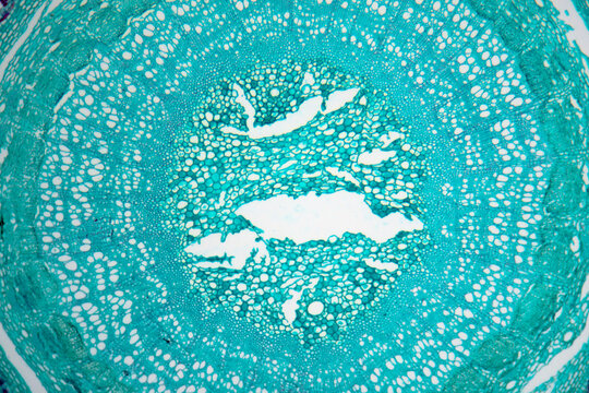 Caulis Sinomenii stem plant cells micrograph