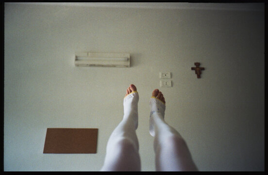 Legs in compression stockings