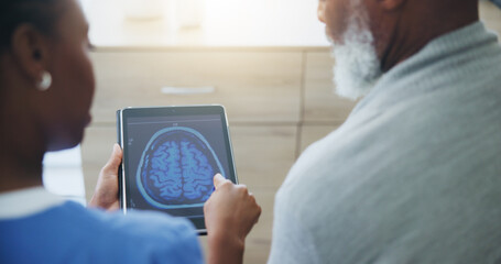 Healthcare, tablet screen or brain scan by doctor with old man for medical, analysis or diagnosis....
