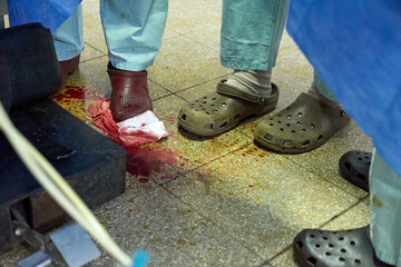 Bloodstained Floor in Surgical Operating Room