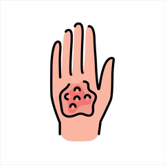 Burns line color icon. Household injuries sign for web page