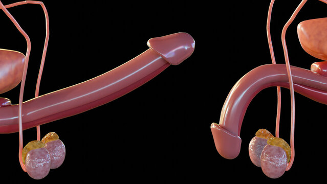 3d rendering of anatomically flaccid and erect states of human penises