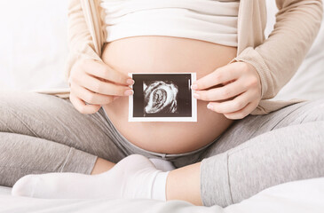 Pregnant woman holding baby ultrasound photo near her big belly, closeup