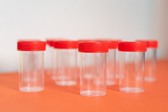 Flacons d'&eacute;chantillons, flacon m&eacute;dical, flacon d'&eacute;chantillon d'urine, laboratoire, test
