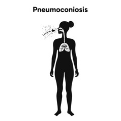 Pneumoconiosis, icons version 