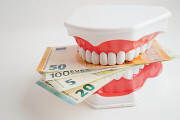 Treatment dental care cost, dental expense or fee, Euro banknote money with teeth model.