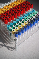 Test tubes with colorful samples in laboratory. Laboratory stand with multi-colored test tubes on the table close-up. Blood samples