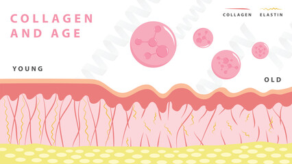 Aging process. comparison of young and aged skin. collagen, elastin and fibroblasts in younger and older skin. flat vector 2d illustration. Concept skin care cosmetics solution.