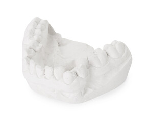 Dental model with gum isolated on white. Cast of teeth