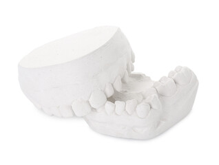 Dental model with gums isolated on white. Cast of teeth