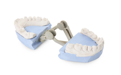 Dental model with gums isolated on white. Cast of teeth