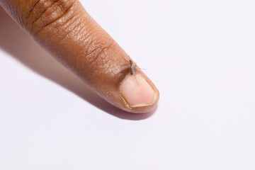 Mosquito Bites Human Finger