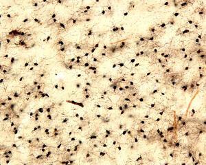 Oligodendrocytes. Golgi silver chromate