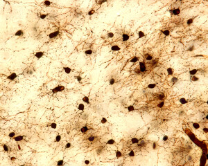 Oligodendrocytes. Golgi silver chromate