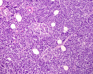 Human pancreas. Langerhans islets
