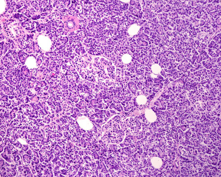 Human pancreas. Langerhans islets