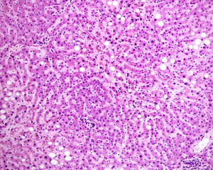 Human liver. Hepatic cords