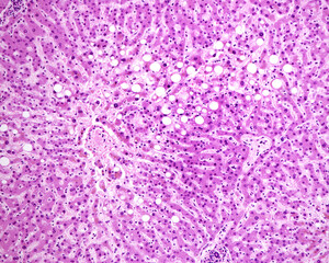 Human liver. Hepatic cords