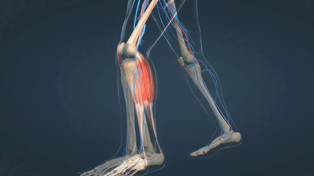 Deep vein Thrombosis