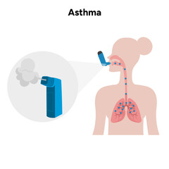 Human take inhaler from asthma zoom inhaler