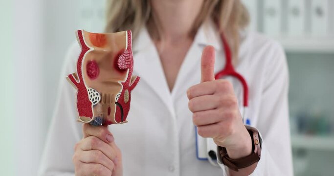 Proctologist shows thumb up holding rectum model with hemorrhoids