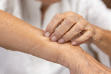 Elderly woman itchy and scratching arm because dry skin.