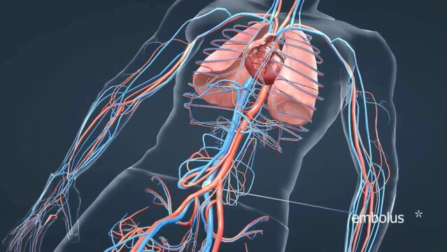 Pulmonary embolism or blood clot in lung