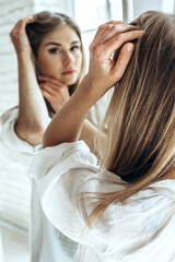 Fototapeta premium Psoriasis, a skin disease in a young woman. Hair problems.