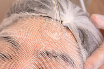 Close-up of an Asian man getting a high frequency facial treatment at a spa. Currently on forehead,...