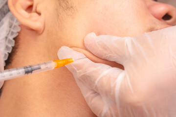 Masseter Jaw Botox, also known as Jawtox procedure - Close-up view of a medical professional or aesthetician administering a botox injection to a patient's jawline at an aesthetic clinic.