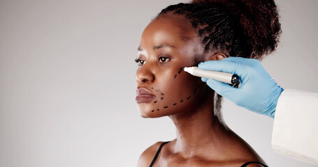 The Aesthetic Journey: A Young Woman Undergoing Facelift Surgery