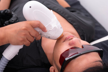 Diode ICE laser hair removal procedure at an aesthetic clinic. Removing facial hair in the beard area from a male asian patient.
