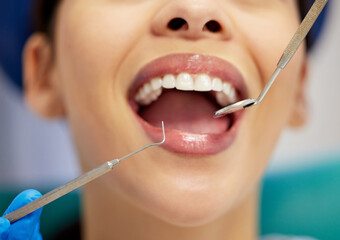 Equipment, mouth and teeth with woman at dentist for oral hygiene or dental care appointment closeup. Checkup, healthcare and medical tools with happy patient in chair at clinic for cleaning or exam