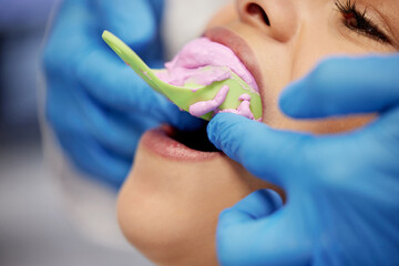 Dentist, dental and rubber dam for toothache in clinic, treatment and health for cleaning mouth....