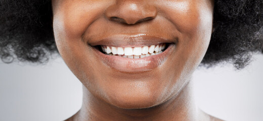 Black woman, mouth closeup and teeth with smile for hygiene, gum health and orthodontics in studio. African girl, tooth zoom and and dental wellness for veneers and fresh breath by white background