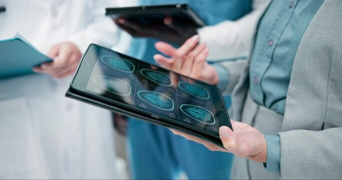 Hands, tablet and brain scan on screen as MRI, cancer and tumor results for consulting on digital health data. Doctor, tech and healthcare collaboration with xray for planning, strategy and neurology