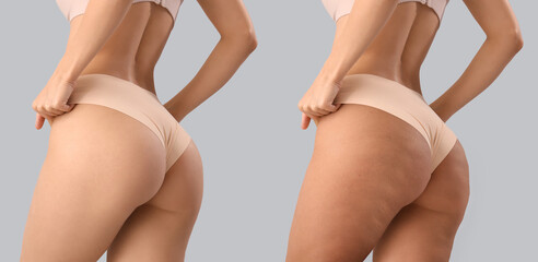 Beautiful young woman in stylish beige underwear on grey background, back view
