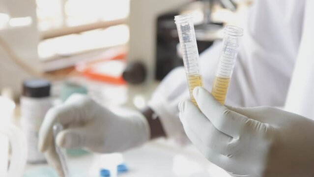 Uganda. 2018/5/11. A laboratory technician is adding urine samples into two test tubes to be centrifuged in order to test for schistosomiasis.