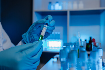 Fototapeta premium A scientist uses laboratory equipment for a research experiment, test tube is essential for chemists to use in experiments, scientific researchers must concentrate on testing samples in the lab