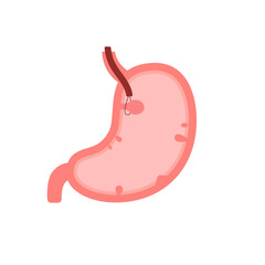 Obraz premium Stomach organ with polyp, gastroscopy and removal polyp. Check health of stomach. Unhealthy gastric, indigestion problems, disease concept. Risk growth cancer cells in stomach. Vector flat illustratio
