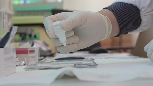 A scientist uses a dropper on HIV rapid test kit, HIV testing, demonstrating HIV testing campaign, VCT day
