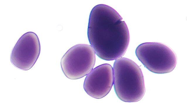 Starch granules of peacock ginger or Indian crocus (Kaempferia rotunda) tuber. Stained by lugol iodine. Objective 40x + camera zoom. Selective focus image