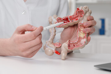 Doctor showing model of large intestine at white table in clinic, closeup