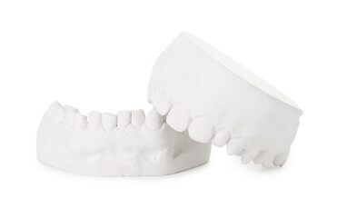Dental model with gums isolated on white. Cast of teeth