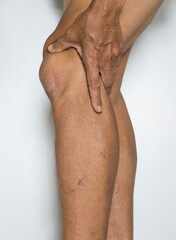 Naklejka premium The leg and knee muscles of an old man who has arthritis problems and the bones and joints of the body on a white background