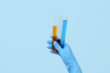 Lab's worker hand with test tubes of colorful samples on blue background