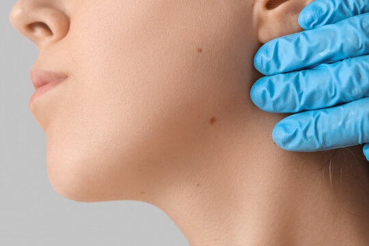Dermatologist examining moles on woman's face against grey background, closeup