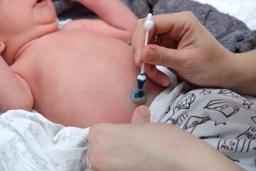 Treatment of newborn baby navel with a cotton swab. Mother's hand and newborn's navel. First days after birth. Daily grooming. Care about baby clean and soft body skin. Closeup.