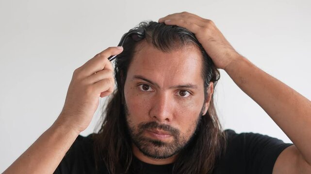 man wearing roller hair on his head to prevent baldness, Hair treatments
