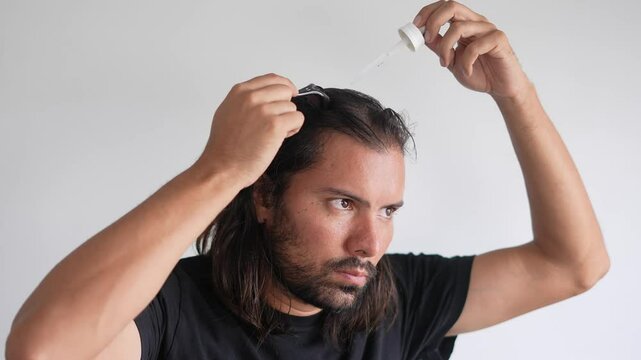 man using roller hair on his scalp to prevent baldness,  Scalp